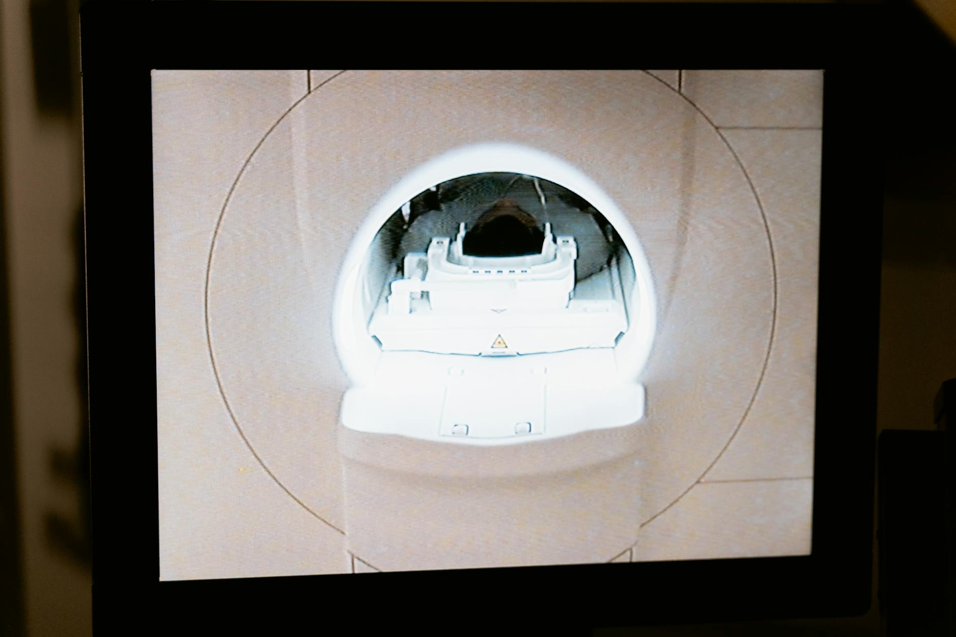 Close-up of an MRI scanner displayed on a monitor in a medical clinic.